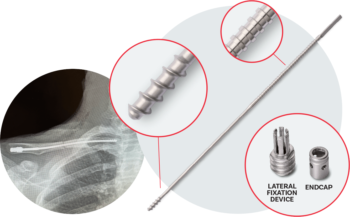Home - The Anser Clavicle Pin