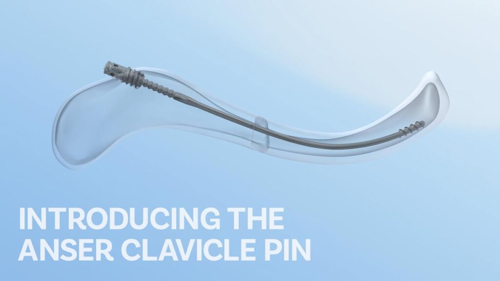 ANSER Clavicle Pin